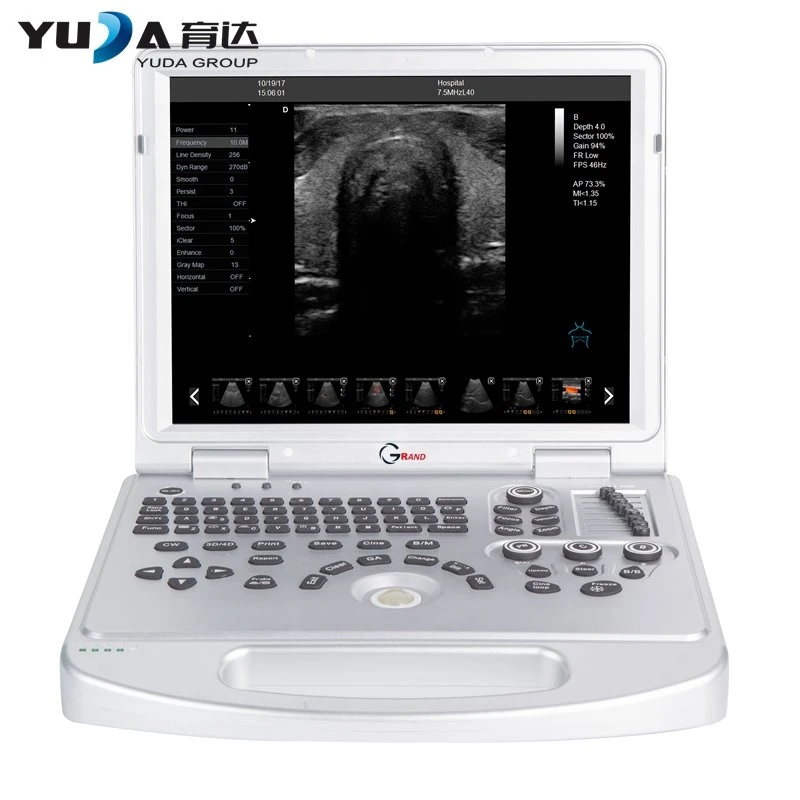 Notebook Full Digital Ultrasound Scanner