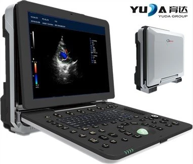 15 pous ki ap dirije Laptop Koule Doppler Ultrasound